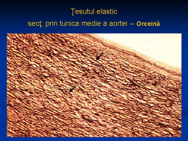 Ţesutul elastic secţ. prin tunica medie a aortei – Orceină 