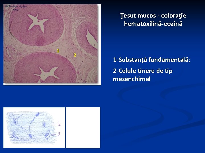 Ţesut mucos - coloraţie hematoxilină-eozină 1 -Substanţă fundamentală; 2 -Celule tinere de tip mezenchimal