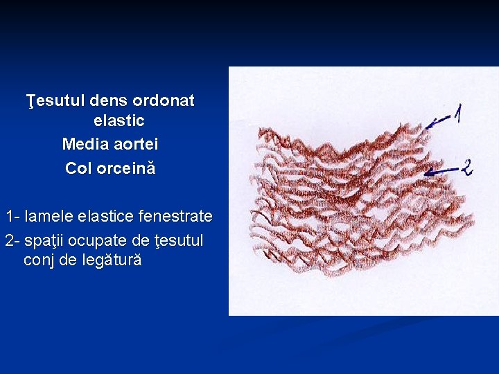 Ţesutul dens ordonat elastic Media aortei Col orceină 1 - lamele elastice fenestrate 2