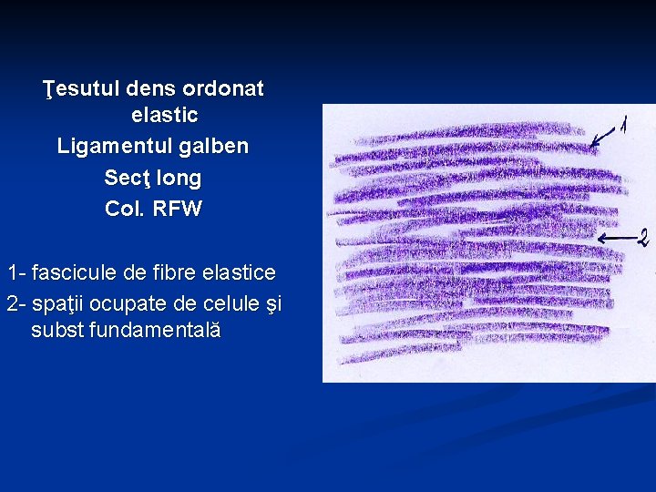 Ţesutul dens ordonat elastic Ligamentul galben Secţ long Col. RFW 1 - fascicule de