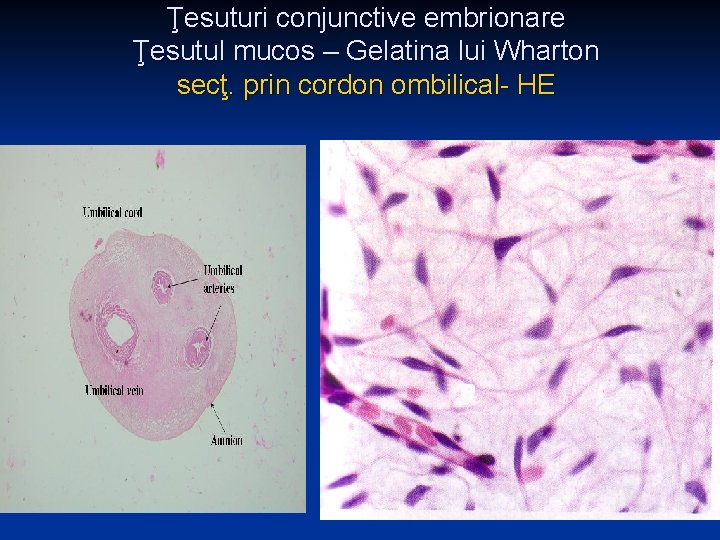 Ţesuturi conjunctive embrionare Ţesutul mucos – Gelatina lui Wharton secţ. prin cordon ombilical- HE