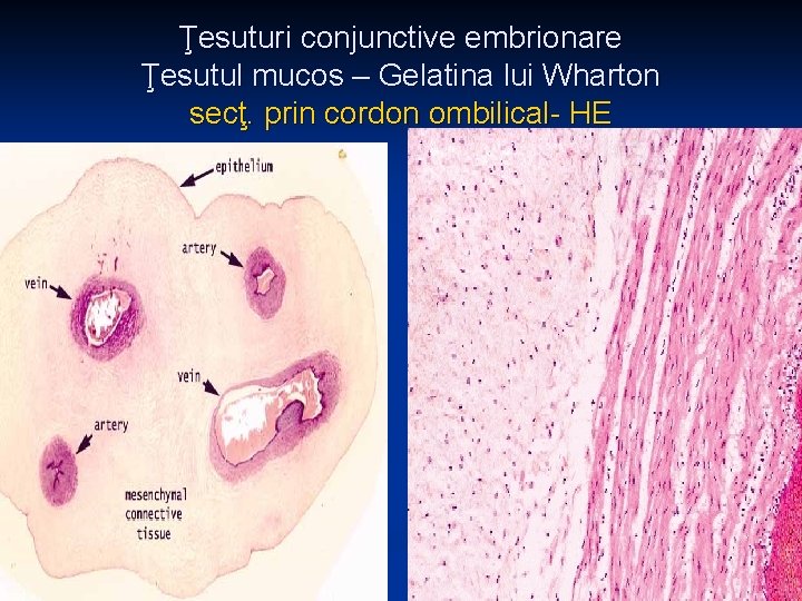 Ţesuturi conjunctive embrionare Ţesutul mucos – Gelatina lui Wharton secţ. prin cordon ombilical- HE