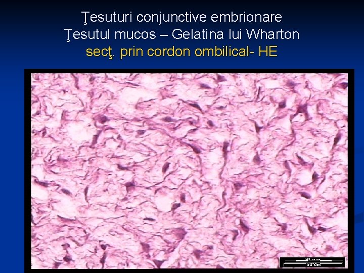 Ţesuturi conjunctive embrionare Ţesutul mucos – Gelatina lui Wharton secţ. prin cordon ombilical- HE