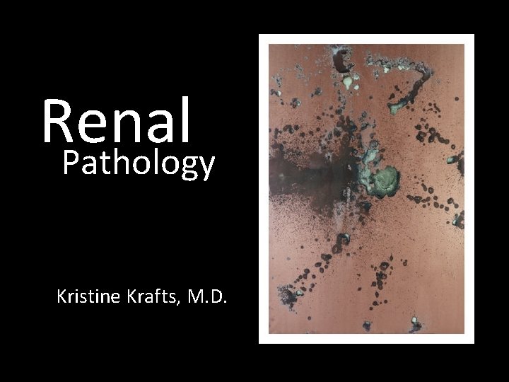 Renal Pathology Kristine Krafts, M. D. 