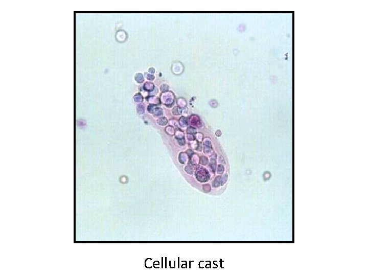 Cellular cast 