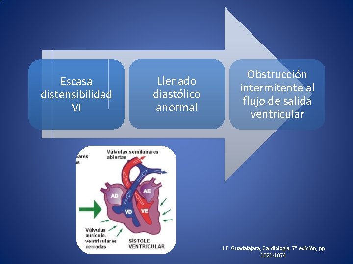 Escasa distensibilidad VI Llenado diastólico anormal Obstrucción intermitente al flujo de salida ventricular J.