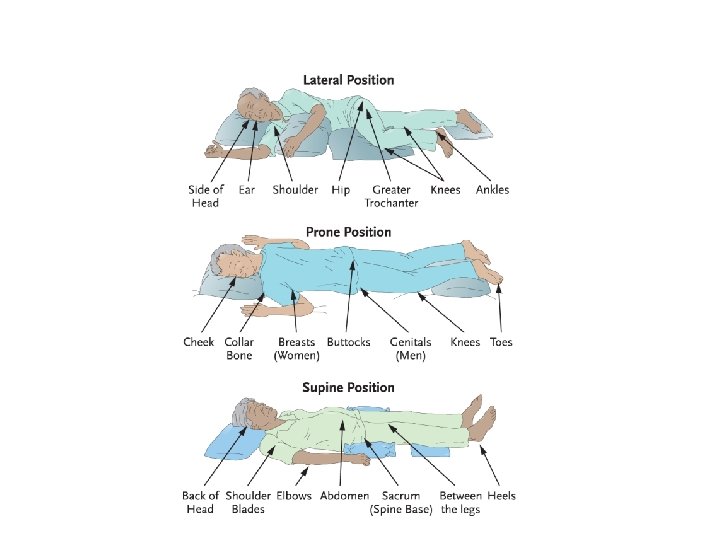 Transparency 13 -2: Pressure Injury Danger Zones 