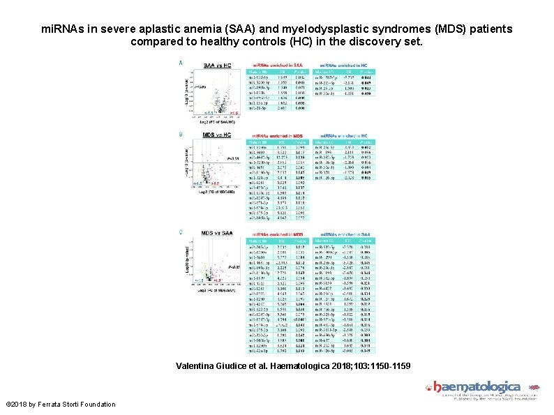 mi. RNAs in severe aplastic anemia (SAA) and myelodysplastic syndromes (MDS) patients compared to