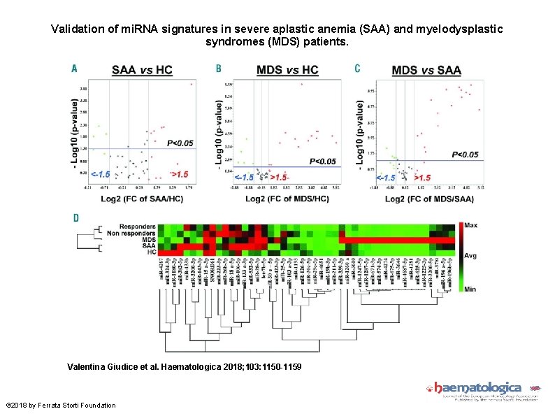 Validation of mi. RNA signatures in severe aplastic anemia (SAA) and myelodysplastic syndromes (MDS)