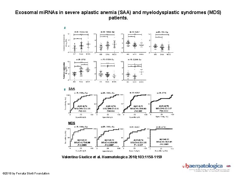 Exosomal mi. RNAs in severe aplastic anemia (SAA) and myelodysplastic syndromes (MDS) patients. Valentina