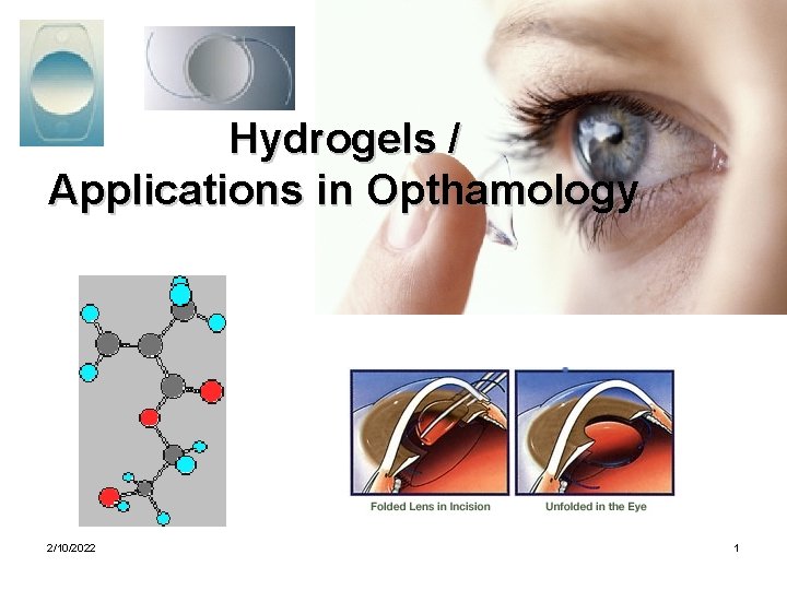 Hydrogels / Applications in Opthamology 2/10/2022 1 