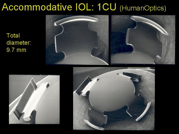 Accommodative IOL: 1 CU (Human. Optics) Total diameter: 9. 7 mm 2/10/2022 43 
