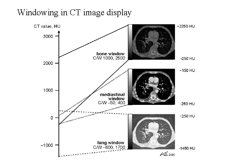 Windowing in CT image display 