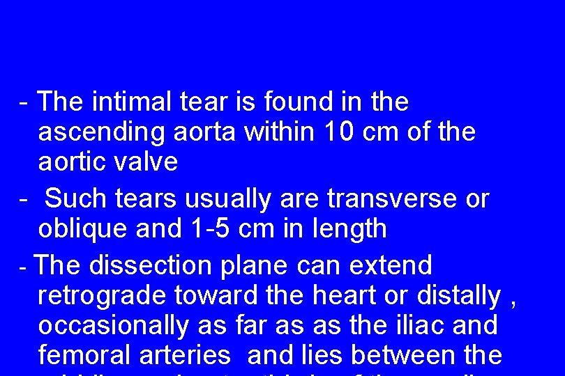- The intimal tear is found in the ascending aorta within 10 cm of