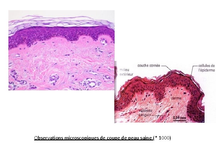 Observations microscopiques de coupe de peau saine (* 1000) 