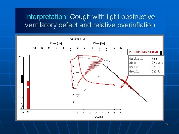 Interpretation: Cough with light obstructive ventilatory defect and relative overinflation 74 
