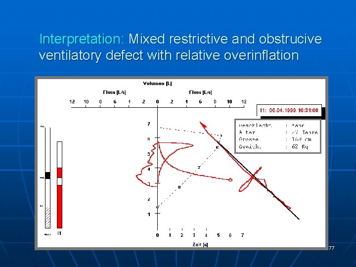Interpretation: Mixed restrictive and obstrucive ventilatory defect with relative overinflation 77 