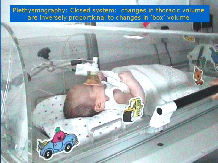 Plethysmography: Closed system: changes in thoracic volume are inversely proportional to changes in ‘box’