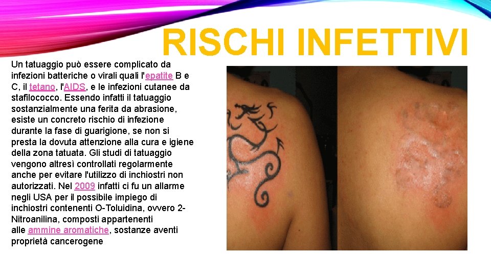 RISCHI INFETTIVI Un tatuaggio può essere complicato da infezioni batteriche o virali quali l'epatite