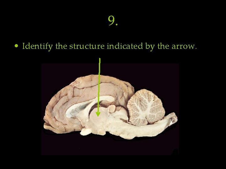 9. • Identify the structure indicated by the arrow. 