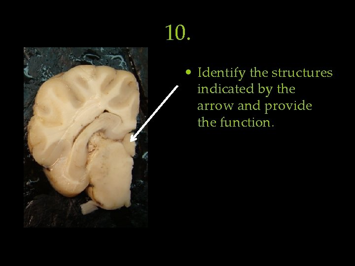 10. • Identify the structures indicated by the arrow and provide the function. 