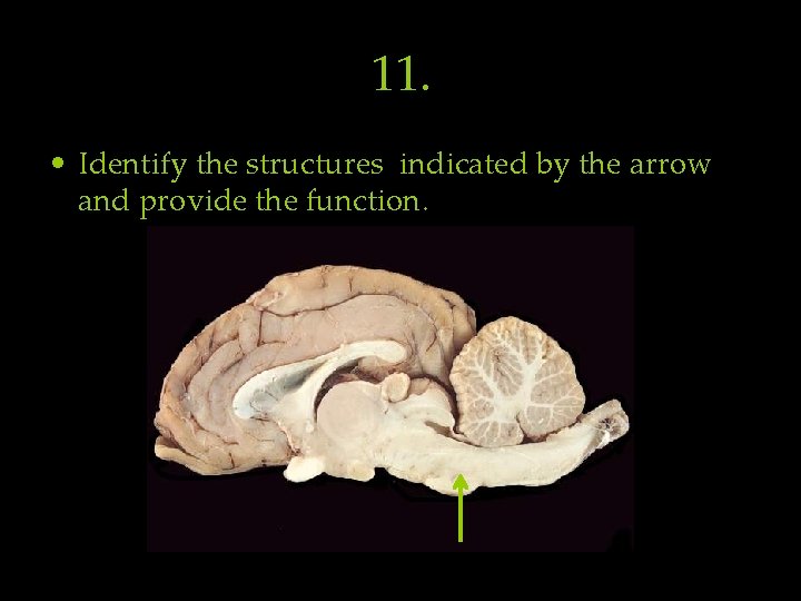 11. • Identify the structures indicated by the arrow and provide the function. 