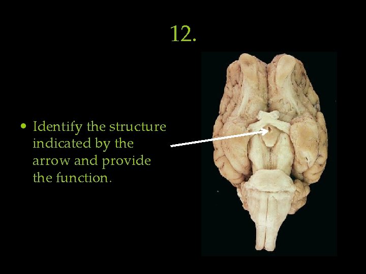 12. • Identify the structure indicated by the arrow and provide the function. 