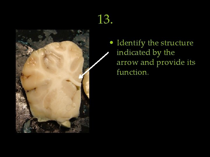 13. • Identify the structure indicated by the arrow and provide its function. 