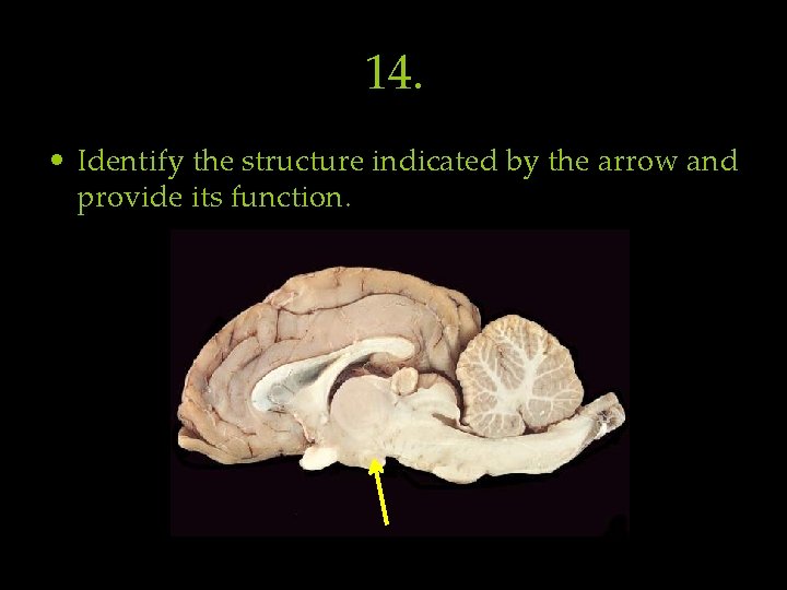 14. • Identify the structure indicated by the arrow and provide its function. 