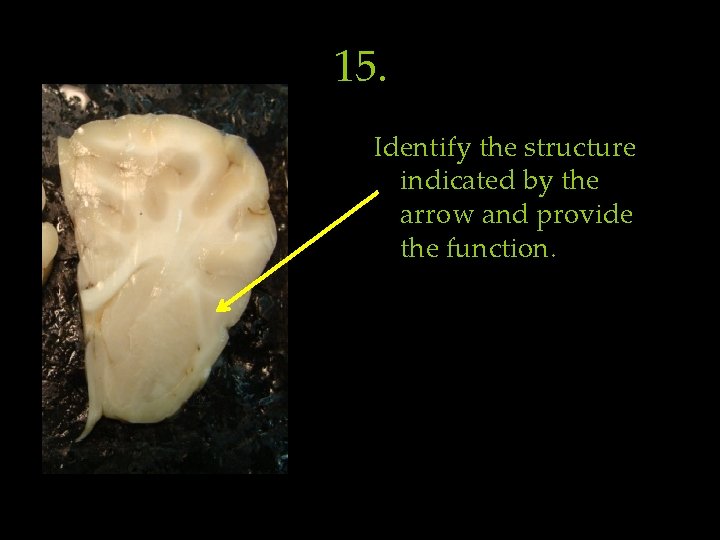 15. Identify the structure indicated by the arrow and provide the function. 