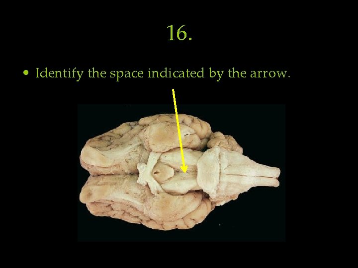 16. • Identify the space indicated by the arrow. 