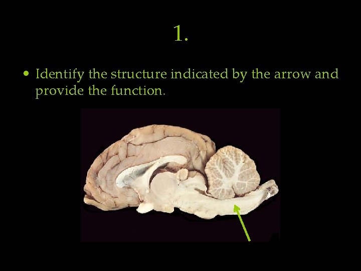 1. • Identify the structure indicated by the arrow and provide the function. 