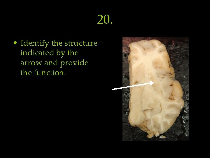 20. • Identify the structure indicated by the arrow and provide the function. 