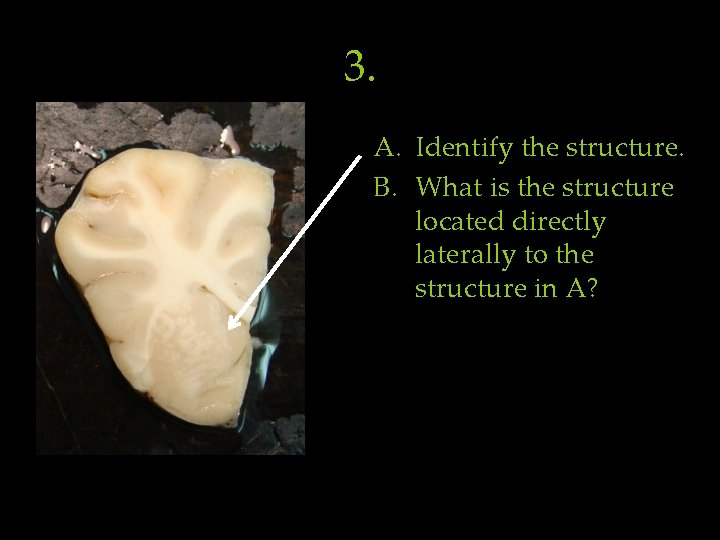 3. A. Identify the structure. B. What is the structure located directly laterally to