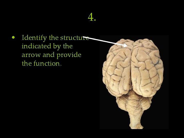 4. • Identify the structure indicated by the arrow and provide the function. 