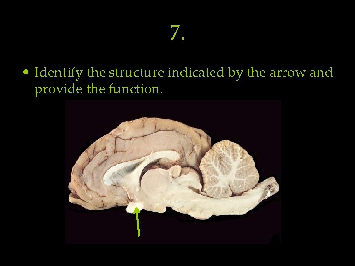 7. • Identify the structure indicated by the arrow and provide the function. 