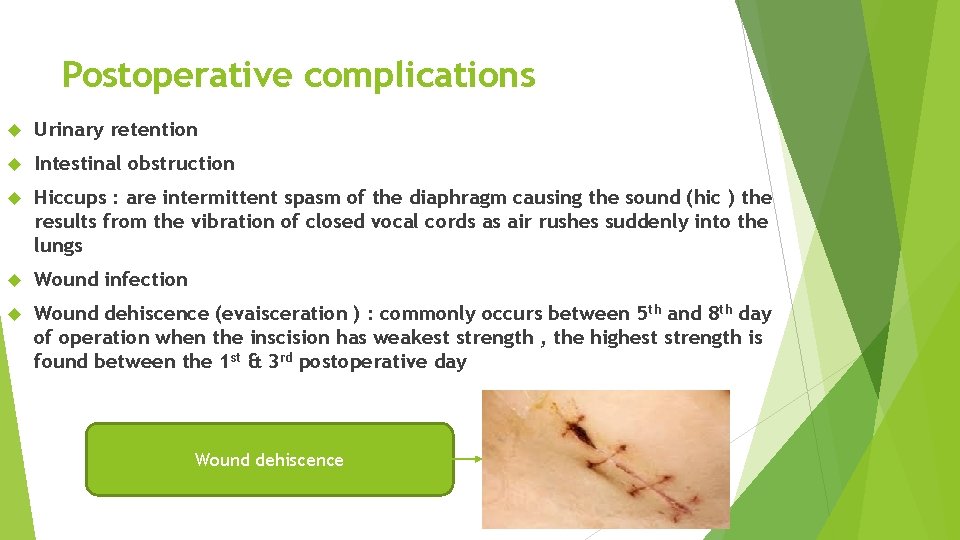 Postoperative complications Urinary retention Intestinal obstruction Hiccups : are intermittent spasm of the diaphragm