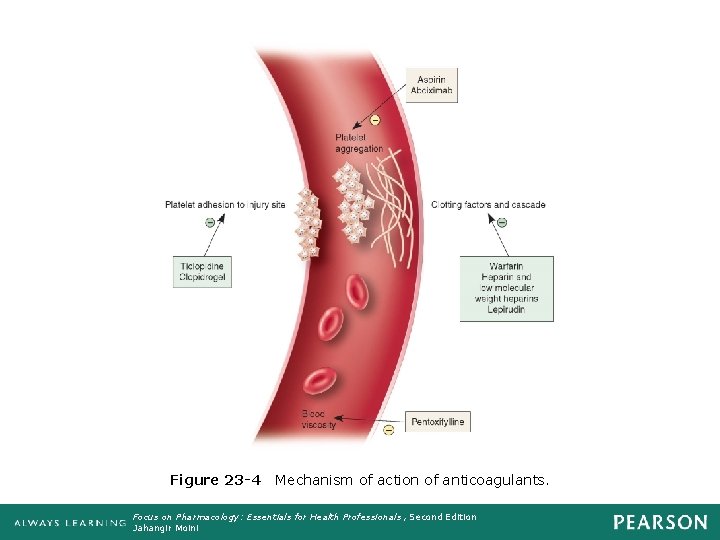 Figure 23 -4 Mechanism of action of anticoagulants. Focus on Pharmacology: Essentials for Health