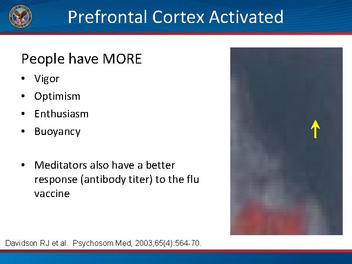 Prefrontal Cortex Activated People have MORE • • Vigor Optimism Enthusiasm Buoyancy • Meditators