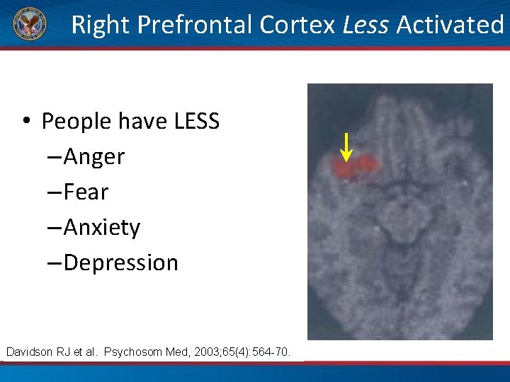 Right Prefrontal Cortex Less Activated • People have LESS – Anger – Fear –