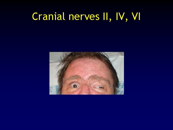 Cranial nerves II, IV, VI 