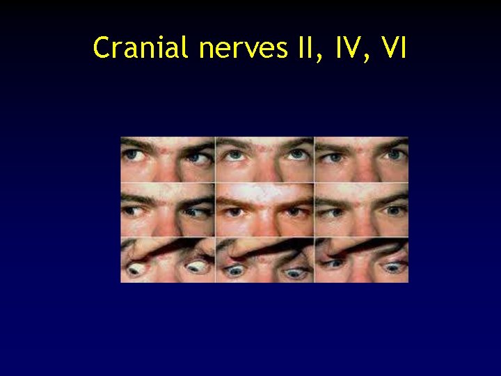 Cranial nerves II, IV, VI 