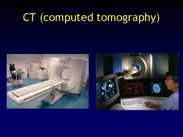 CT (computed tomography) 