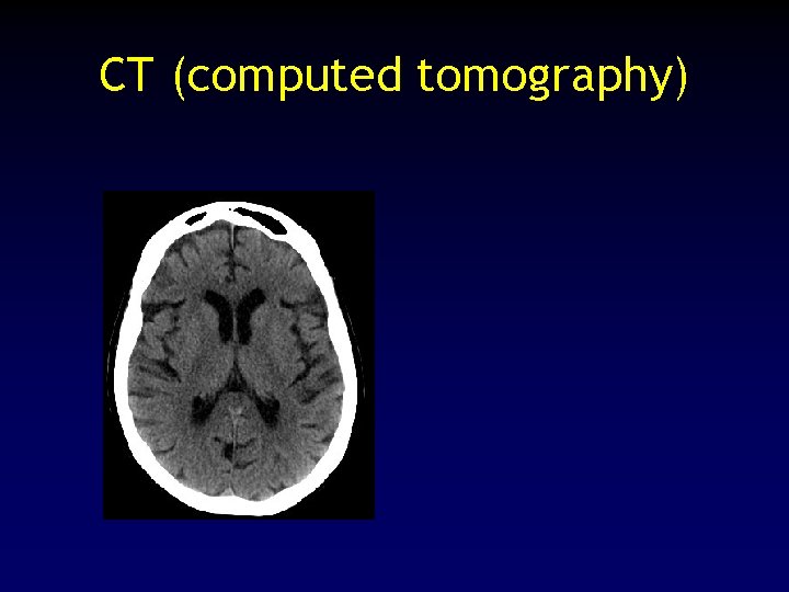 CT (computed tomography) 