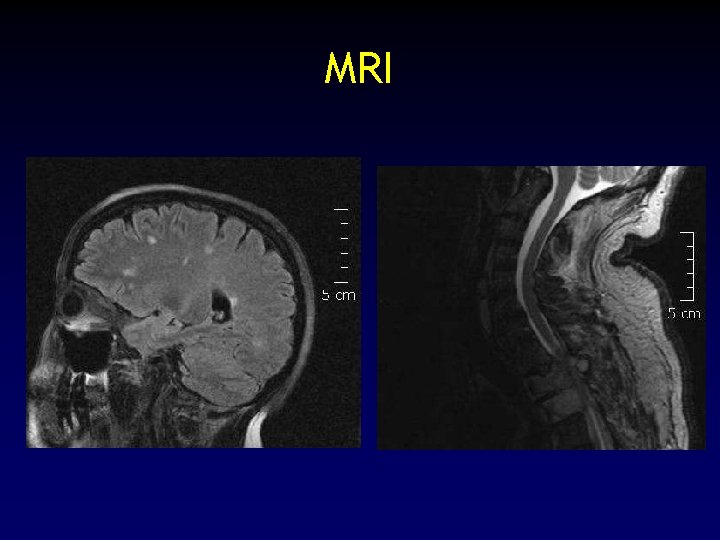 MRI 