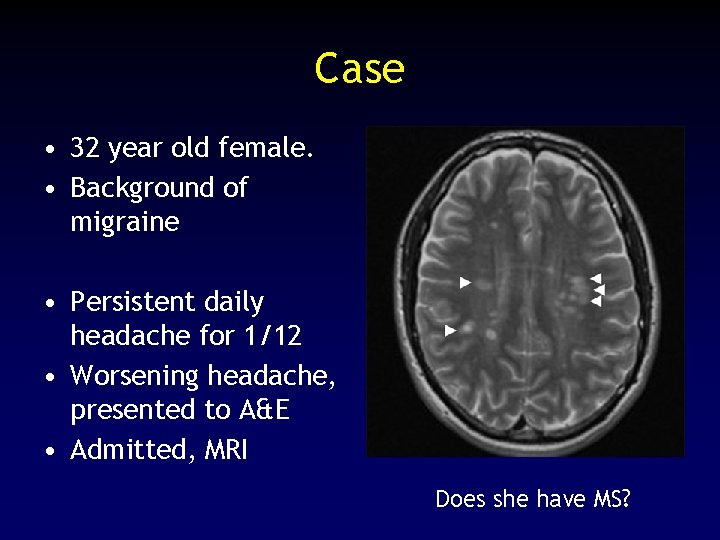 Case • 32 year old female. • Background of migraine • Persistent daily headache