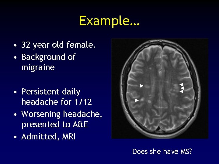 Example… • 32 year old female. • Background of migraine • Persistent daily headache