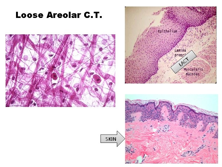 Loose Areolar C. T. CT A L SKIN 