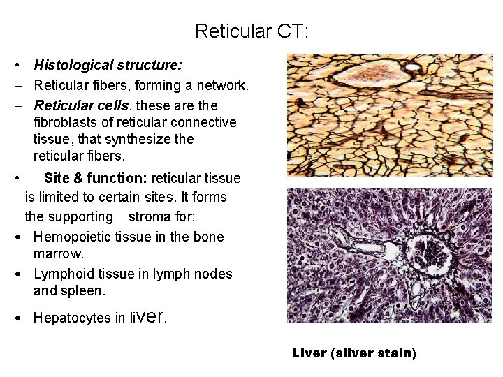 Reticular CT: • Histological structure: Reticular fibers, forming a network. Reticular cells, these are
