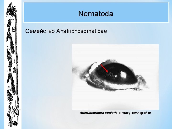 Nematoda Семейство Anatrichosomatidae Anatrichosoma ocularis в глазу землеройки 